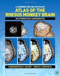 A Combined MRI and Histology Atlas of the Rhesus Monkey Brain