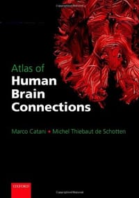 Atlas of Human Brain Connections