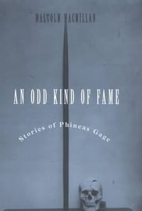 An Odd Kind of Fame