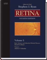 Retina