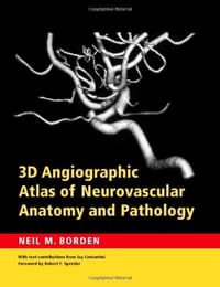 3D Angiographic Atlas of Neurovascular Anatomy and Pathology