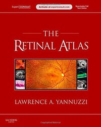 The Retinal Atlas