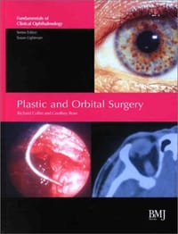 眼眶整形外科 Plastic and Orbital Surgery
