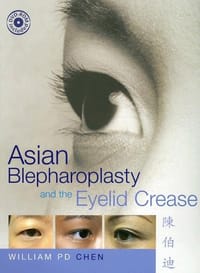 书籍 Asian Blepharoplasty and the Eyelid Crease with DVD的封面