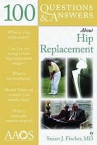 100 Questions and Answers About Hip Replacement