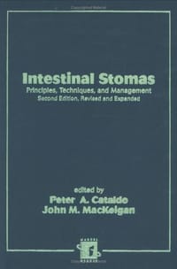 Intestinal Stomas - Cataldo, Peter A. (EDT)/ Mackeigan, John M. (EDT)