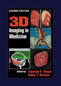 3D Imaging in Medicine, Second Edition