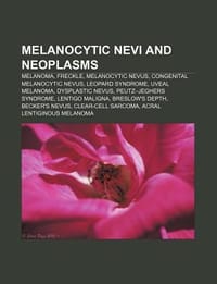 Melanocytic Nevi and Neoplasms