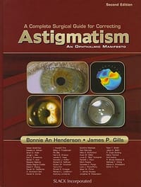 A Complete Surgical Guide for Correcting Astigmatism