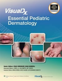 VisualDx