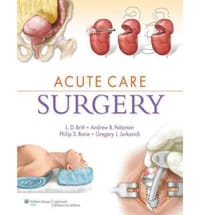 Acute Care Surgery