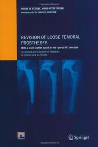 Revision of Loose Femoral Prostheses with a Stem System Based on the "Press-fit" Principle