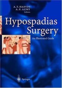 Hypospadias Surgery