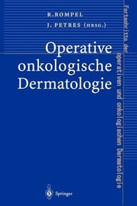 Operative Onkologische Dermatologie