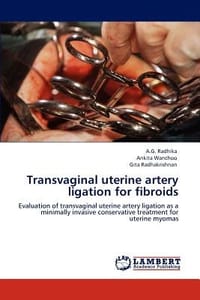 Transvaginal Uterine Artery Ligation for Fibroids