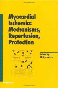 Myocardial Ischemia
