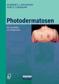 Photodermatosen