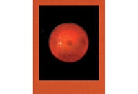 Retinal Shift - Mikhael Subotzky