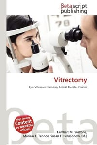 Vitrectomy