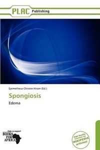 Spongiosis