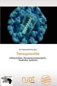 Tenosynovitis