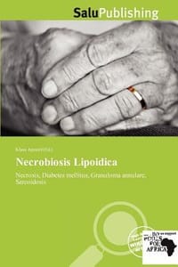 Necrobiosis Lipoidica