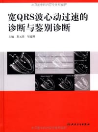 宽QRS波心动过速的诊断与鉴别诊断