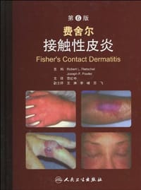费舍尔接触性皮炎