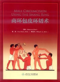 商环包皮环切术