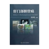 肝门部胆管癌