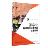 数字化种植导板临床应用技术图解/数字化口腔临床技术图解丛书