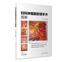 妇科肿瘤腹腔镜手术图解