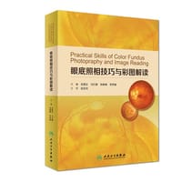 眼底照相技巧与彩图解读