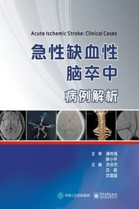 急性缺血性脑卒中病例解析