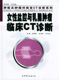 女性盆腔与乳腺肿瘤临床CT诊断 - 刘明娟 编