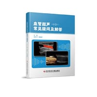 血管超声常见疑问及解答