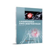 心冲击信号识别技术及其在心脏监护系统中的应用
