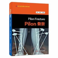 Pilon骨折