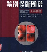 内镜诊断与鉴别诊断图谱