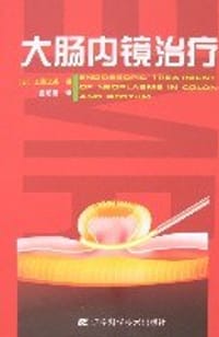 大肠内镜治疗 - 工藤进英