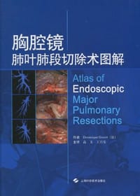 书籍 胸腔镜肺叶肺段切除术图解的封面