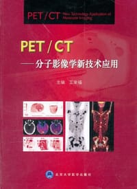 PET/CT
