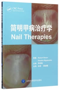 简明甲病治疗学