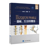 Ilizarov外固定—器械、方法和理念