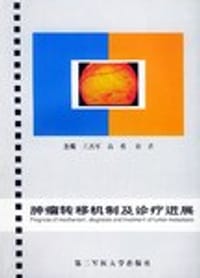 肿瘤转移机制及诊疗进展