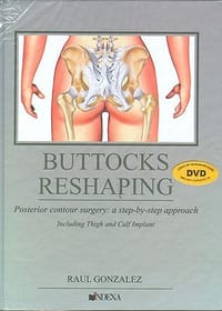 Buttocks Reshaping