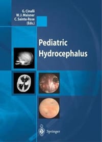 书籍 Pediatric Hydrocephalus的封面